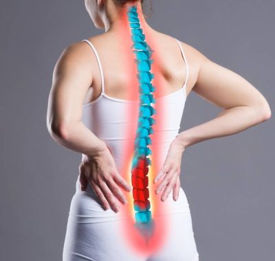 Cervical Spondylosis