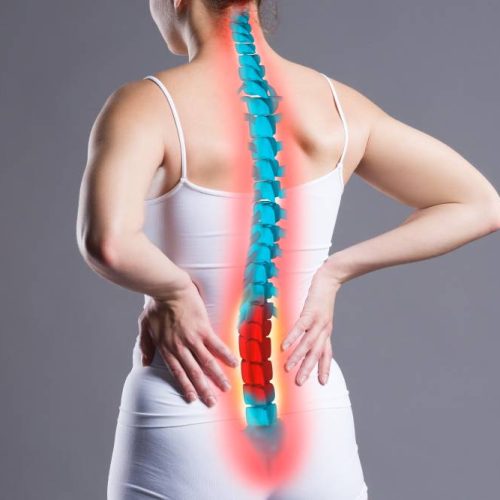 Cervical Spondylosis