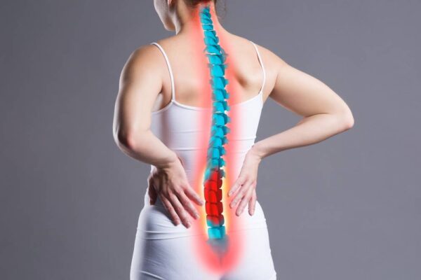 Cervical Spondylosis