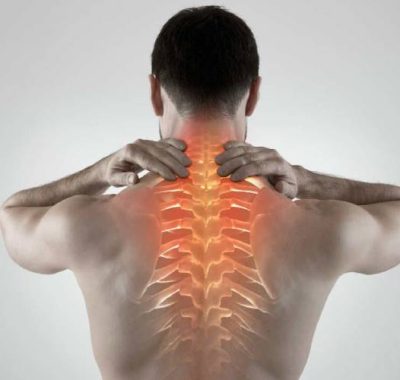 Cervical-Spondylosis