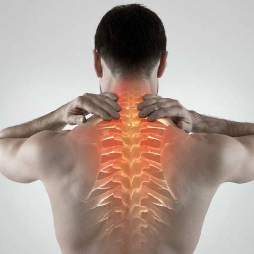 Cervical-Spondylosis