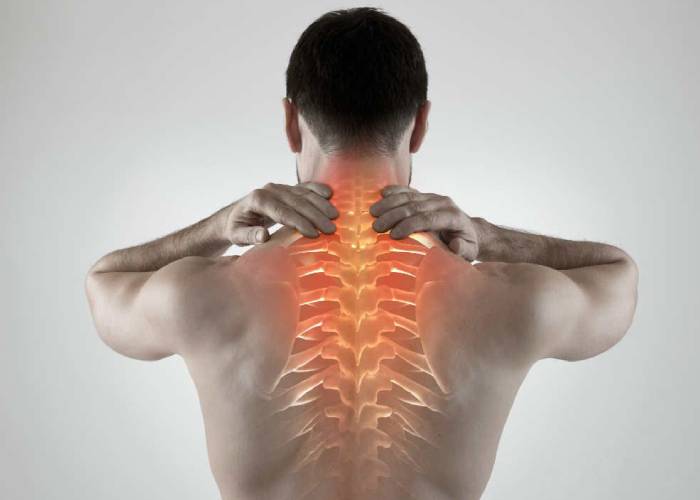 Cervical-Spondylosis Cervical-Spondylosis